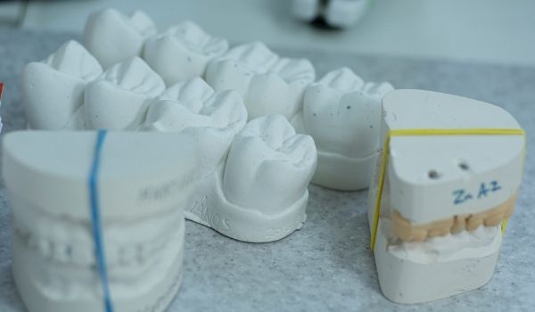 an image of white teeth molds